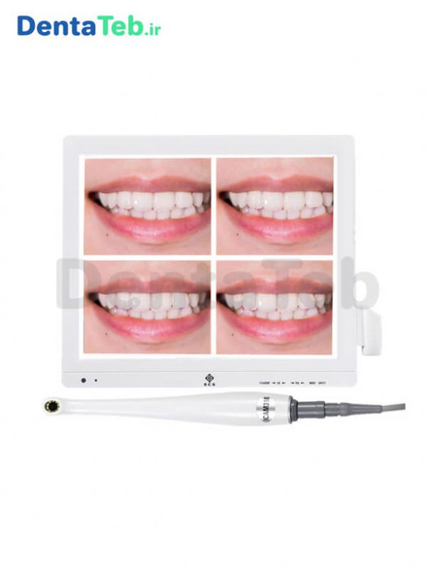 دوربین و مانیتور دندانپزشکی scs | دوربین و مانیتور دندانپزشکی