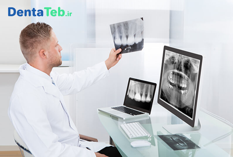 رادیوگرافی دیجیتال دندانپزشکی | دستگاه رادیوگرافی دیجیتال دندانپزشکی