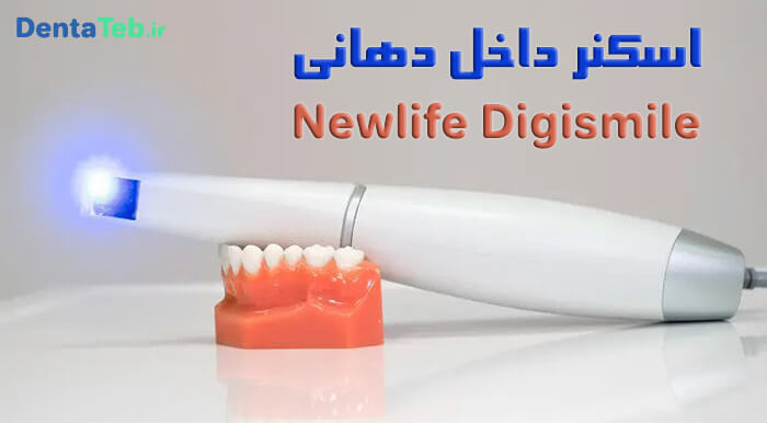 اسکنر داخل دهانی دندانپزشکی نیولایف | نیولایف digismile