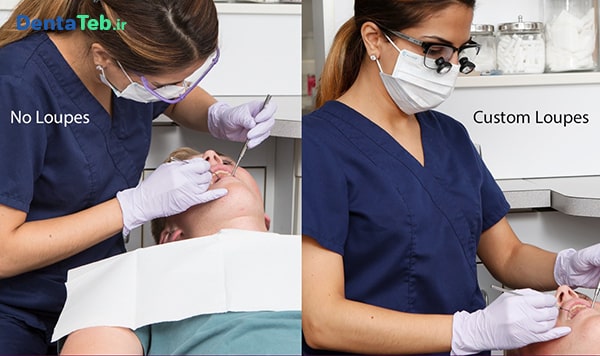 سلامت دندانپزشکان | مزایای لوپ دندانپزشکی